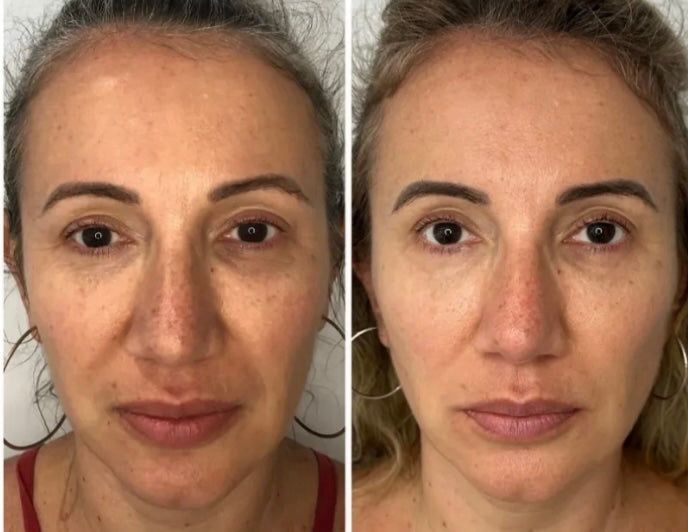 Collagen Fit ™  Collagen Rejuvenating Mask